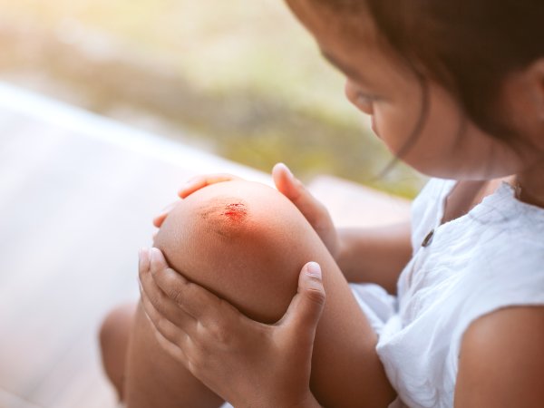 Mädchen mit blutendem Knie pingpao - AdobeStock